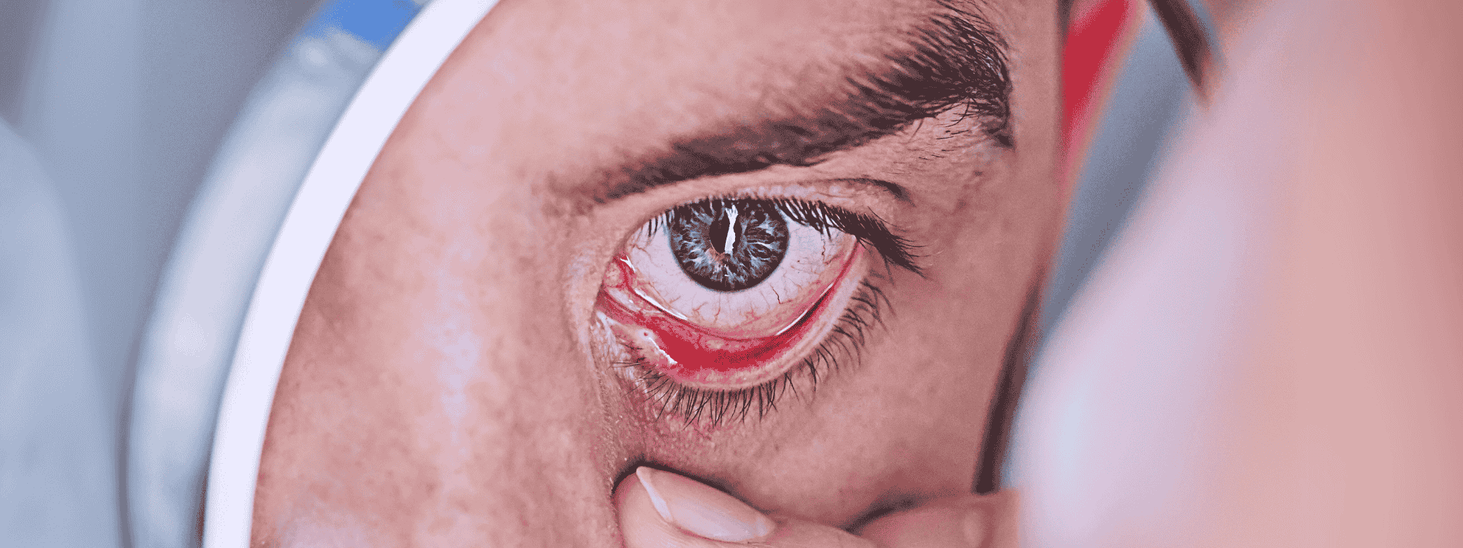 Occhi rossi: cosa li causa?